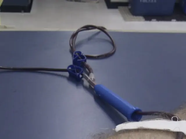 Debate over Organ Donation: Advantages of Opt-In versus Opt-Out Registration Methods